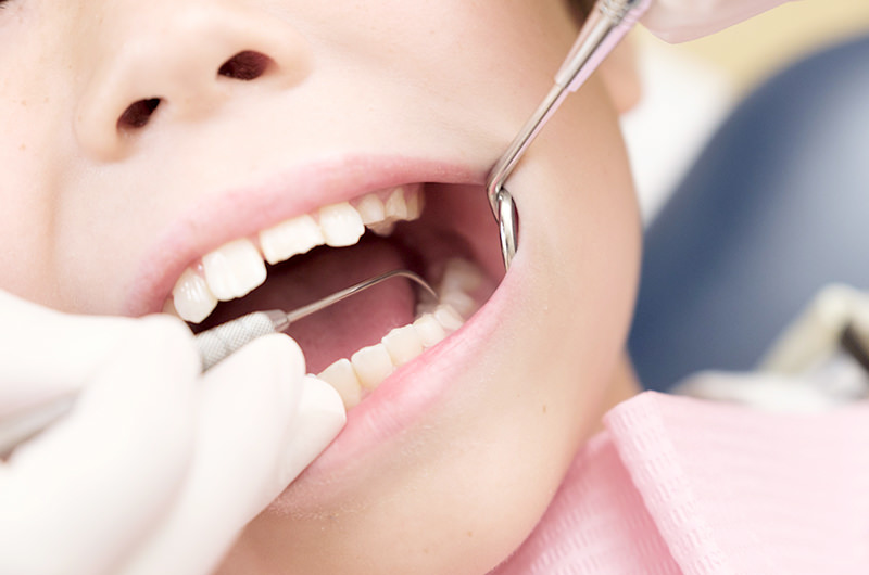 くぼ歯科クリニックこども歯科クリニックの予防歯科